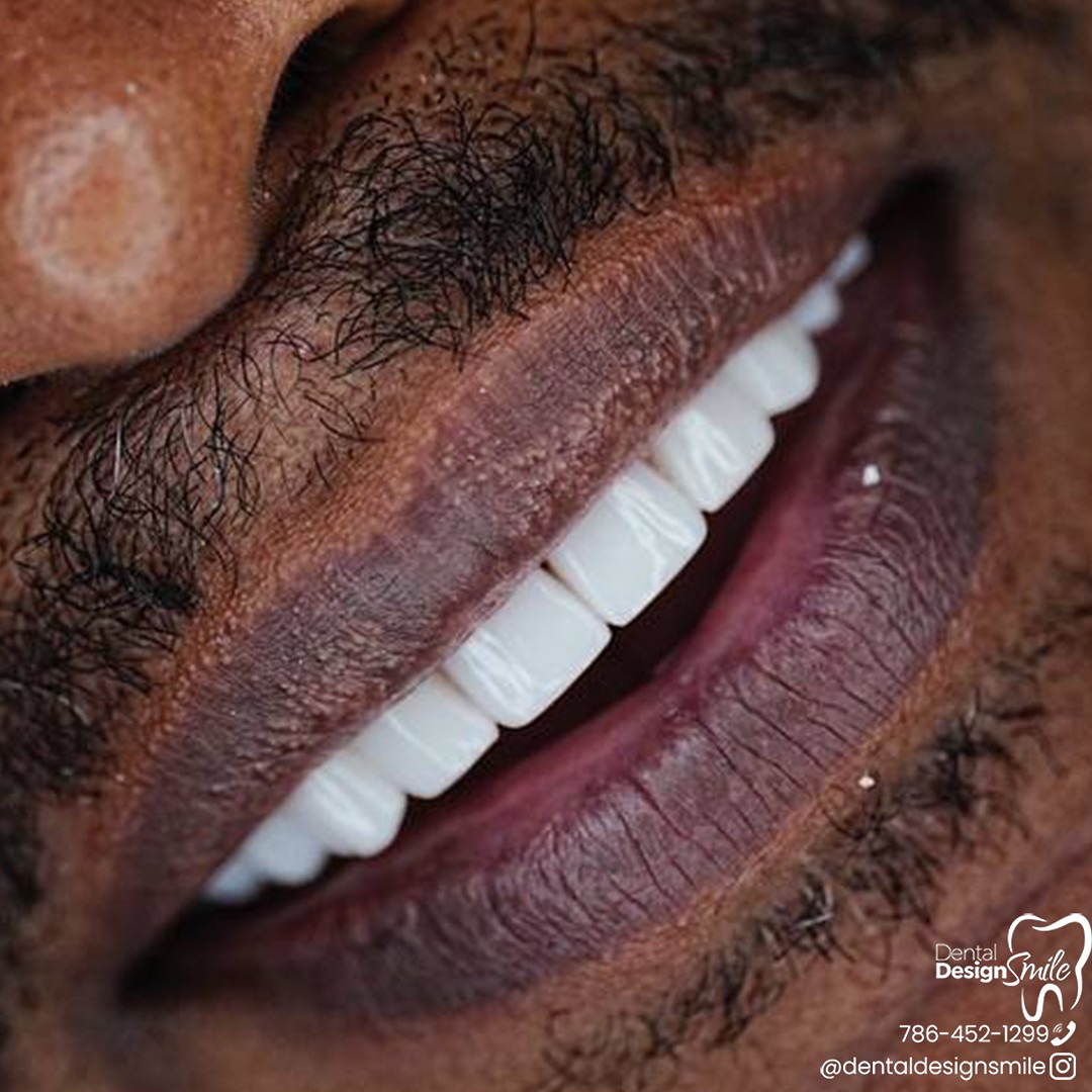 Dental Design Smile Miami