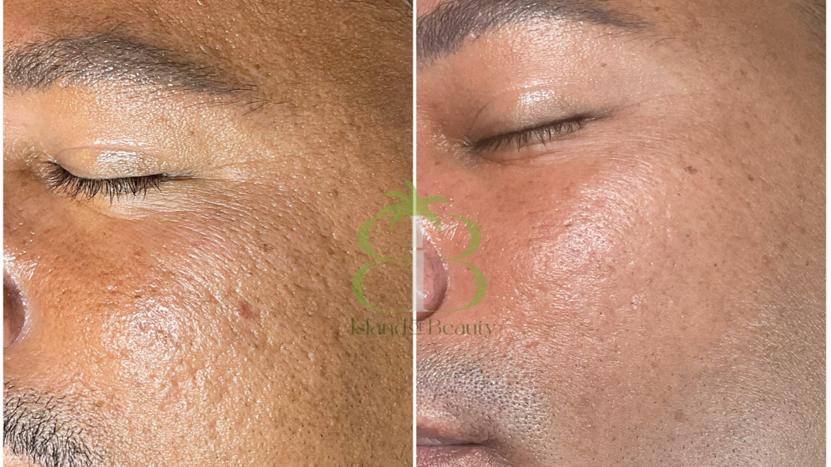 Island of Beauty Facial Spa Miramar