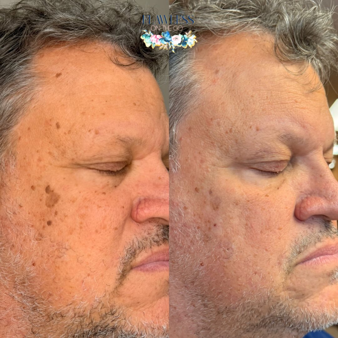 Flawless On The Go | Medical Spa Ocala