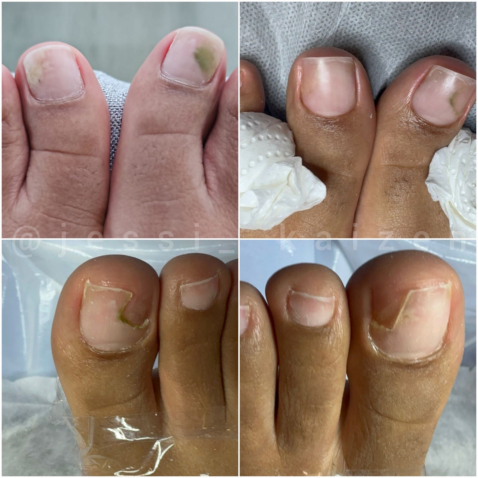 Jessi Kaizen Nail Artist and Foot Care