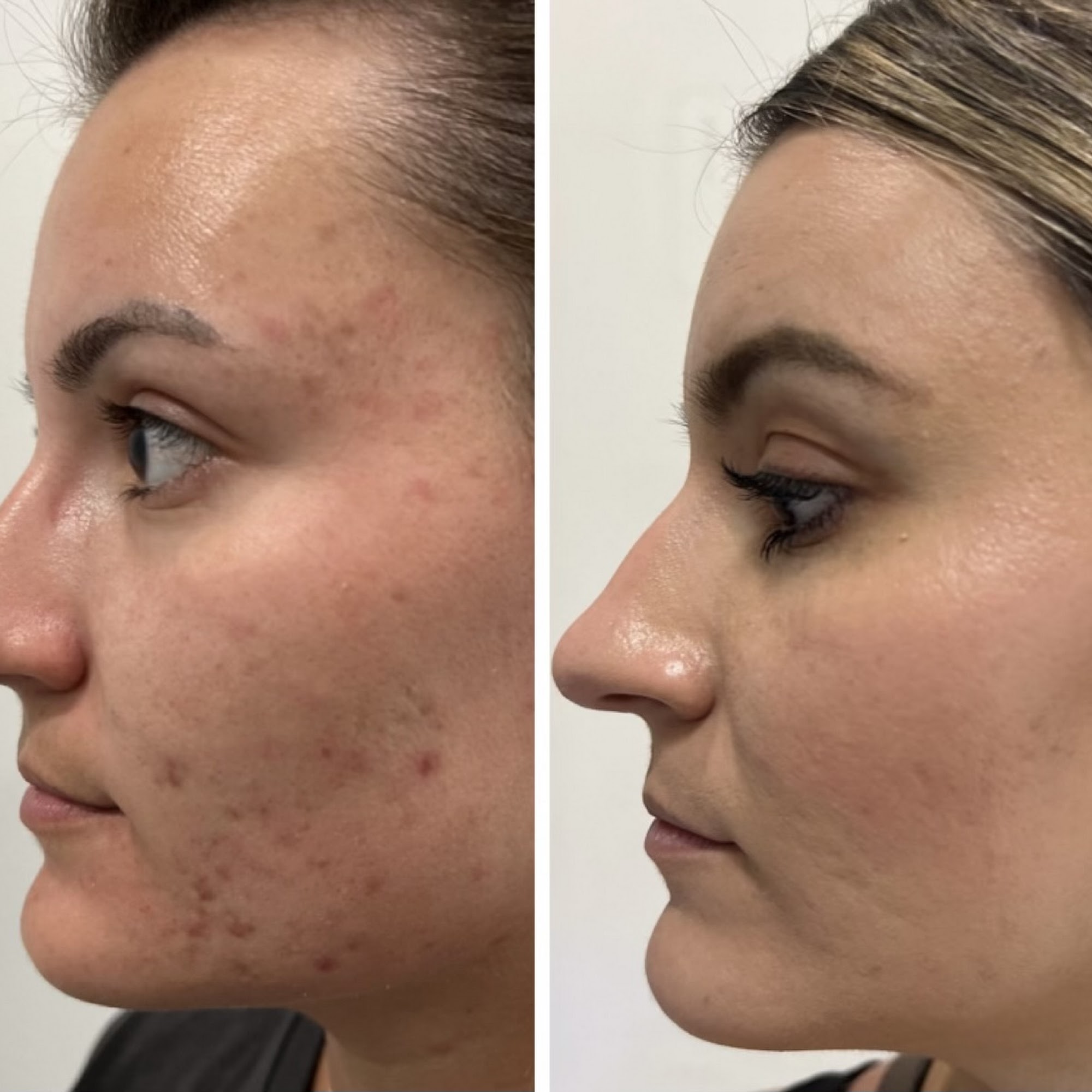 Skin Health By Deniz 1520 Longleaf Pine Pkwy Studio 115, St Johns Florida 32259