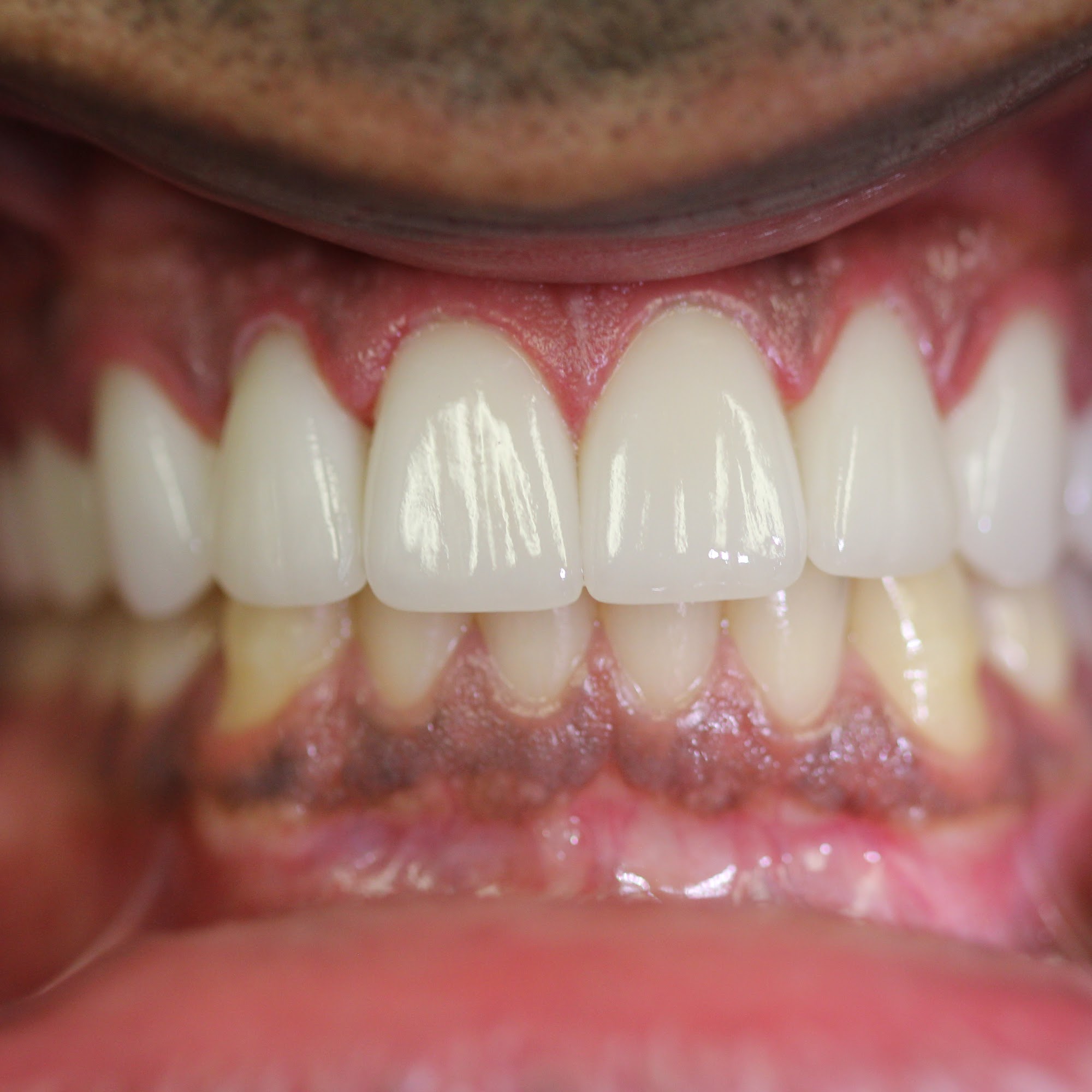 Weston Dental Center 1040 Weston Rd STE 225, Weston Florida 33326