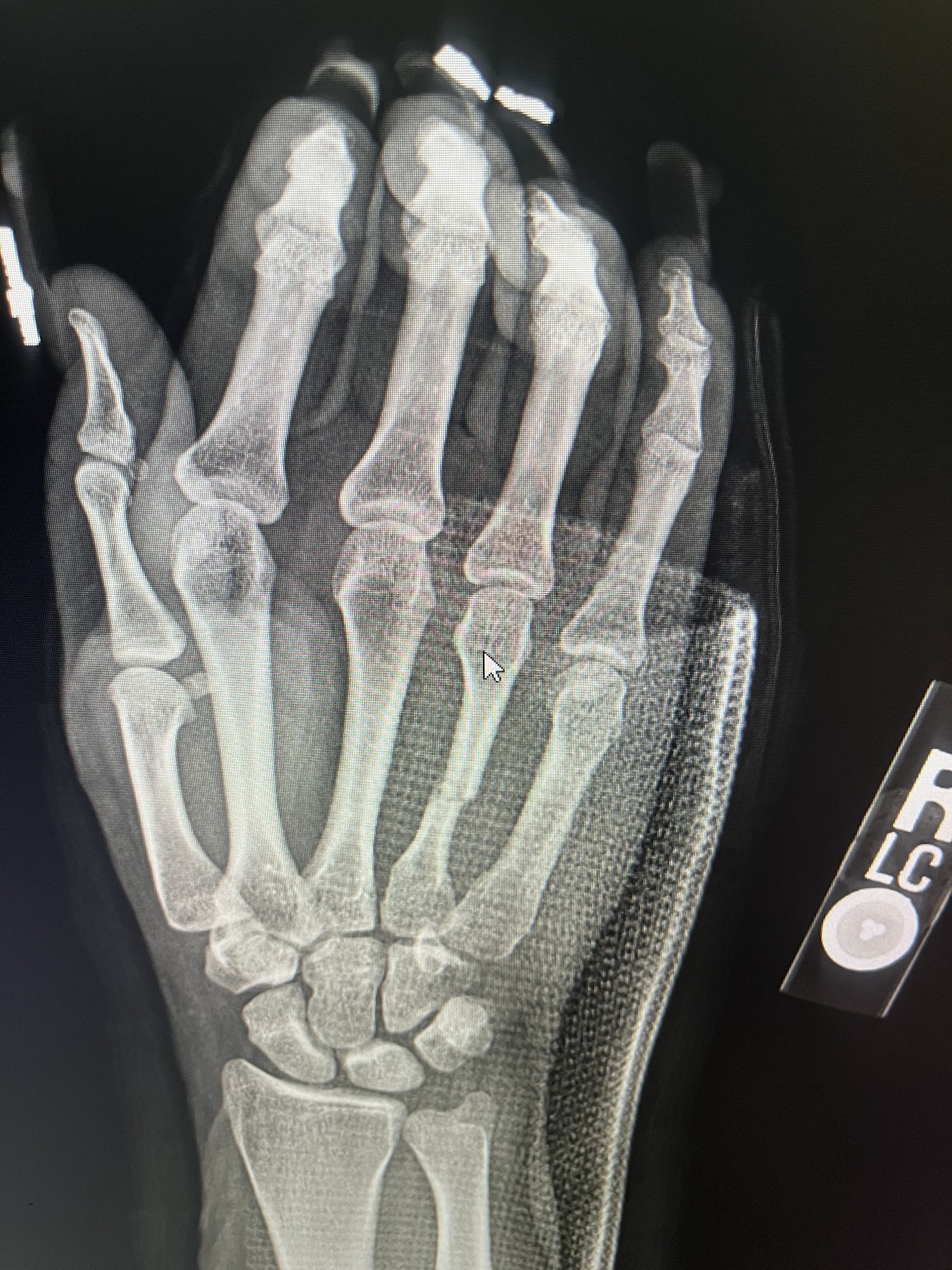 Piedmont Orthopedics of Thomson