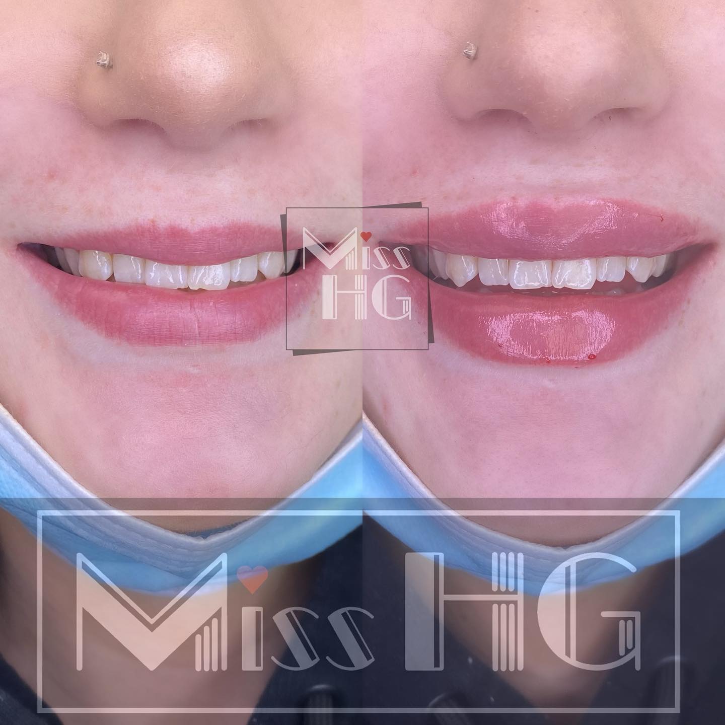 Miss HG