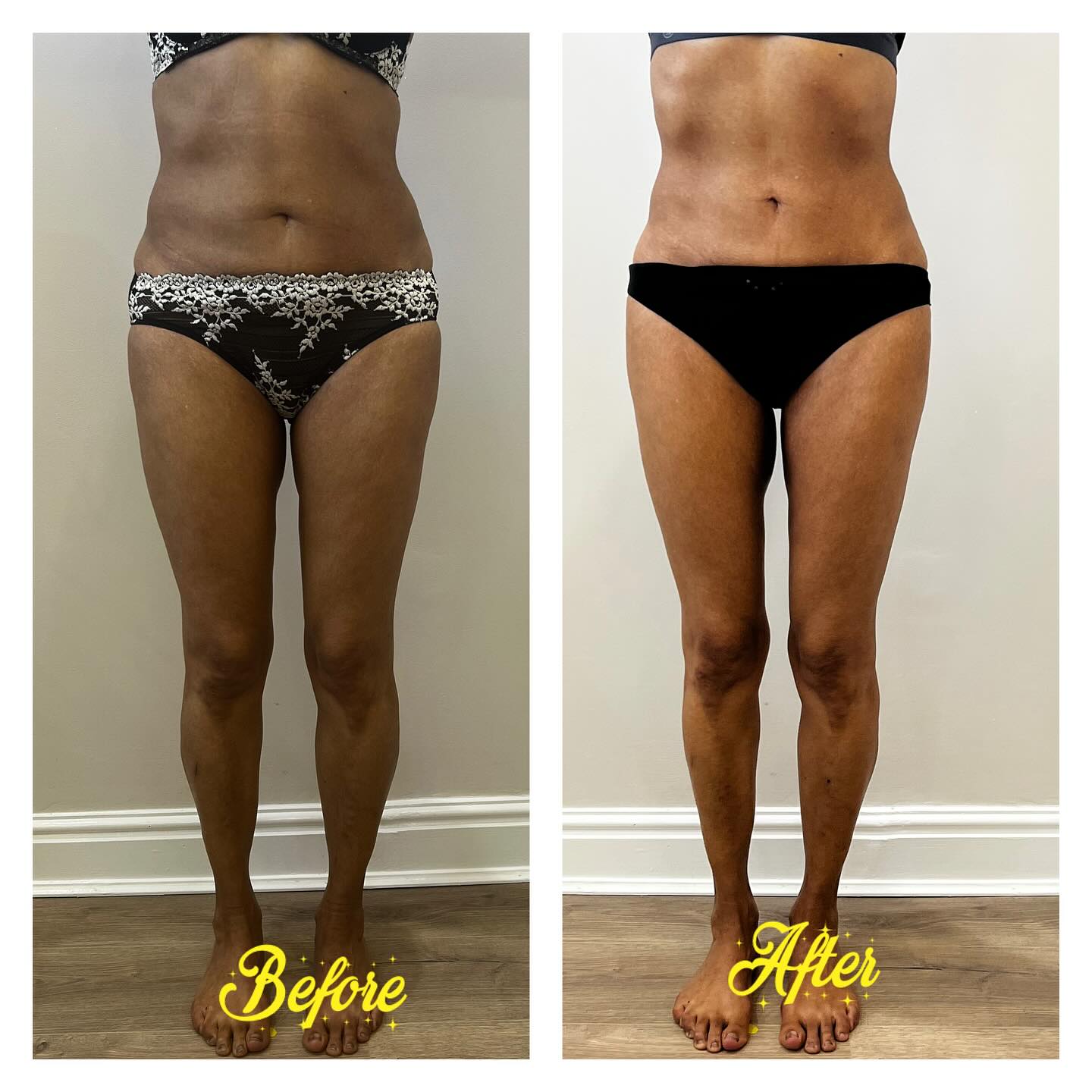 Endermika LPG Endermologie Beauty Studio