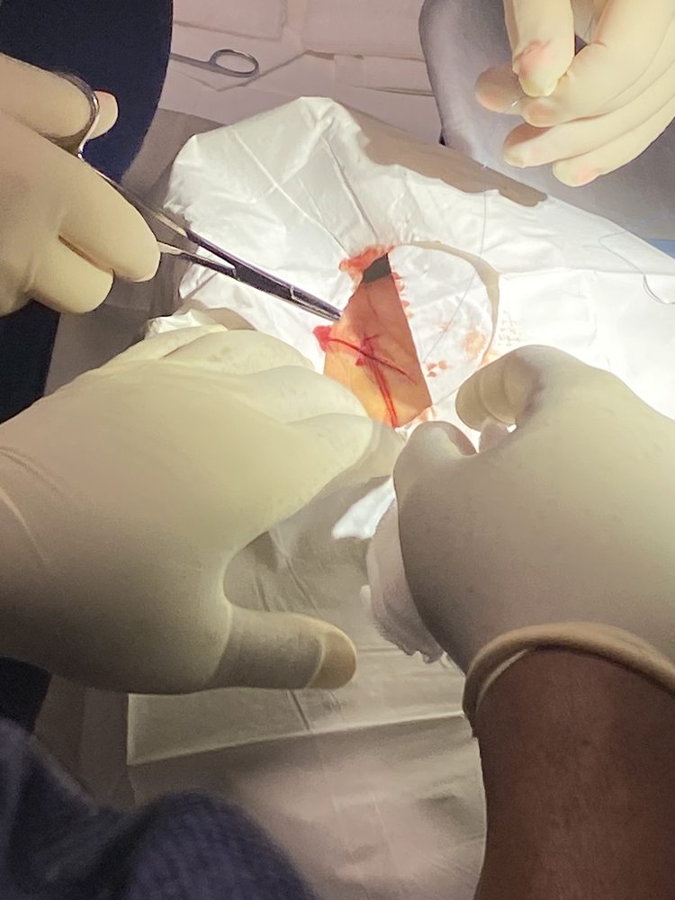 Offenberger Martin E MD