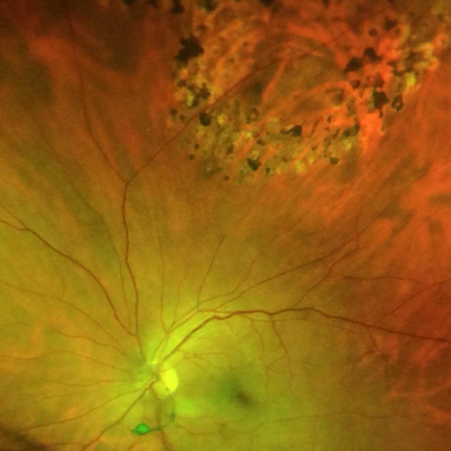 Decatur Eyecare Associates