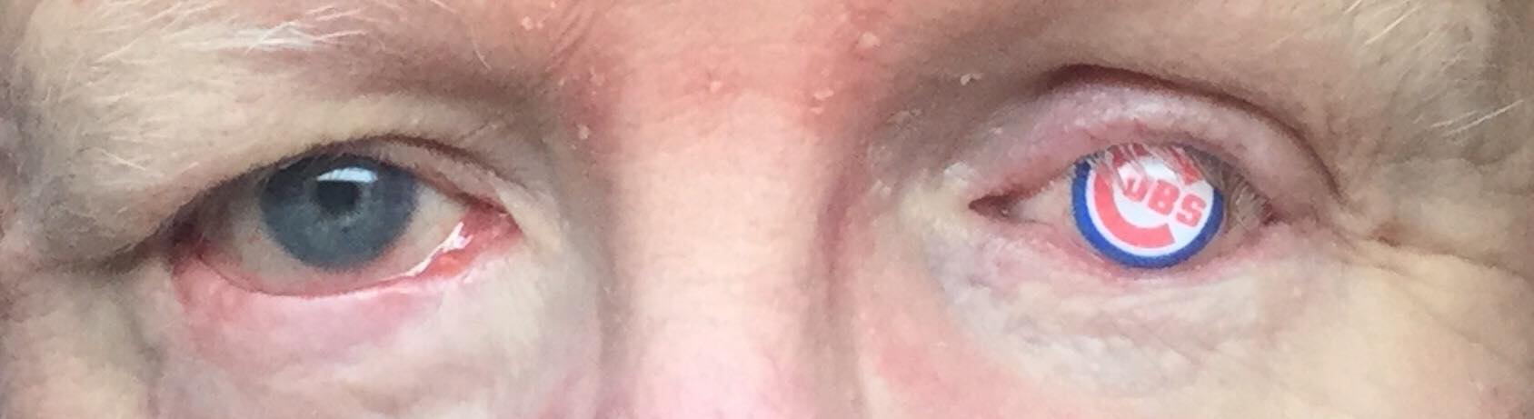 June RR Nichols Ocularist Ltd Chicago