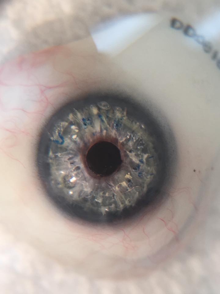 June RR Nichols Ocularist Ltd Chicago