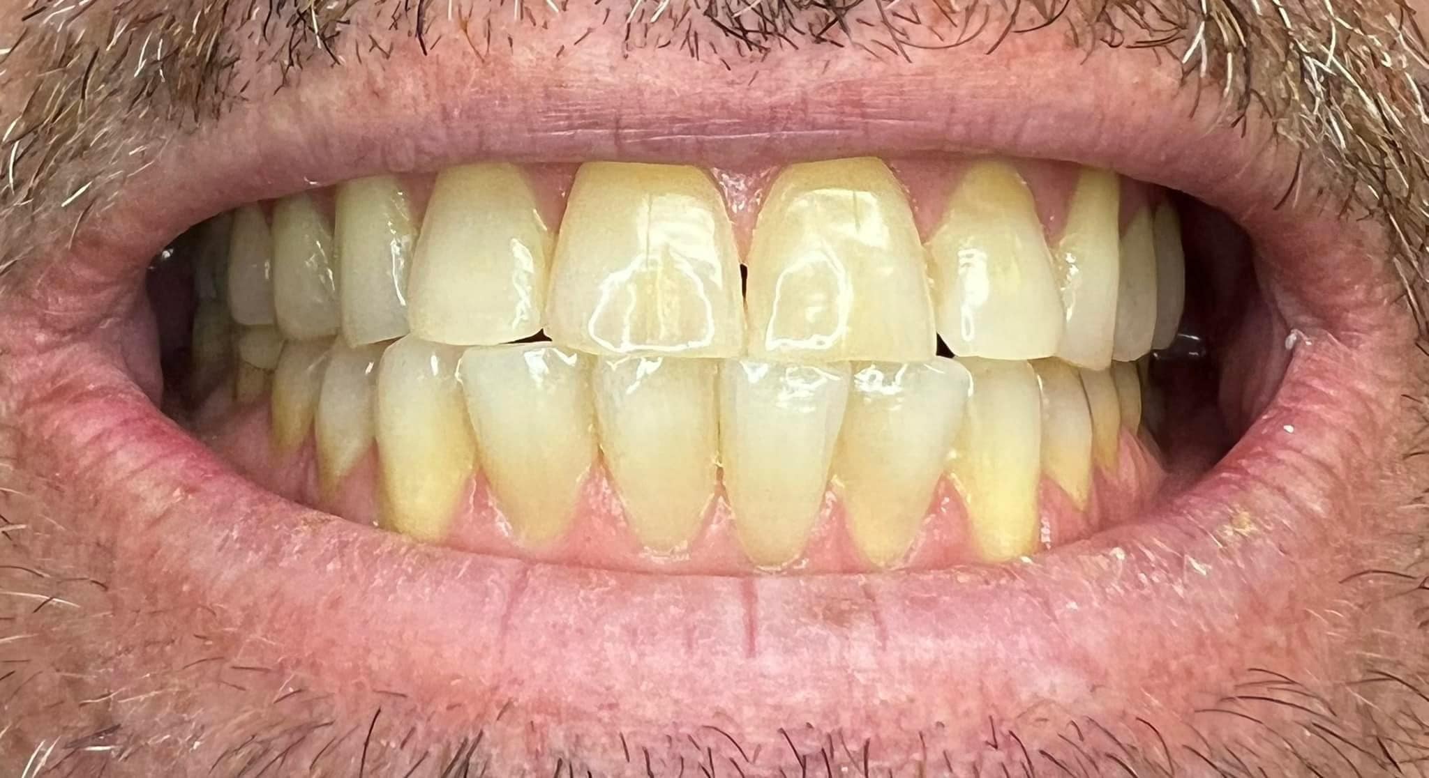 Dr. William M. Wilkin, DDS 1130 17th St, Fulton Illinois 61252