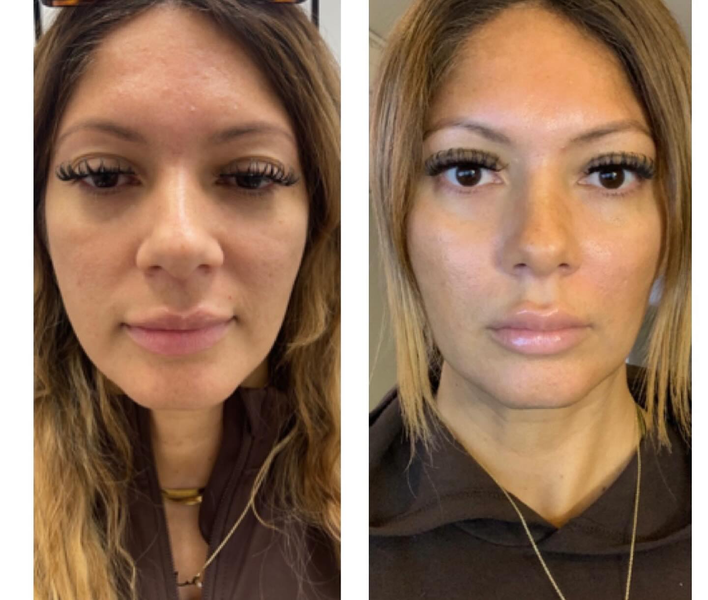 Aesthetic Angels Beauty Bar 200 S Prospect Ave Suite LL100, Park Ridge Illinois 60068