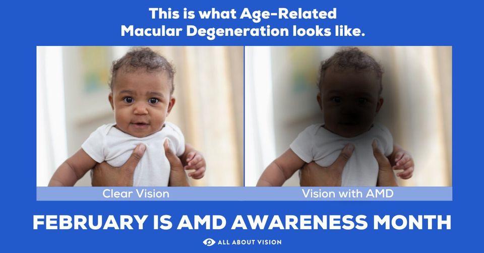 Boulevard Place Eye Care