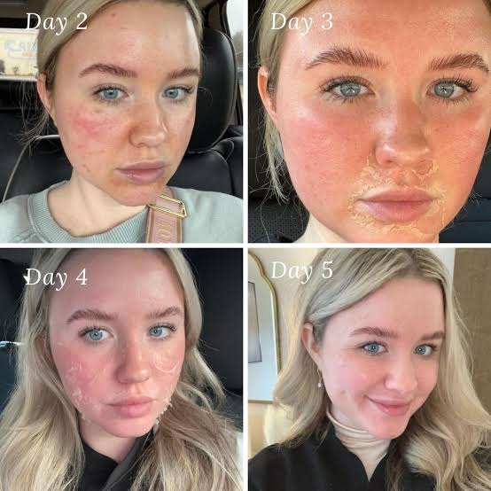 La Bella Skin Care