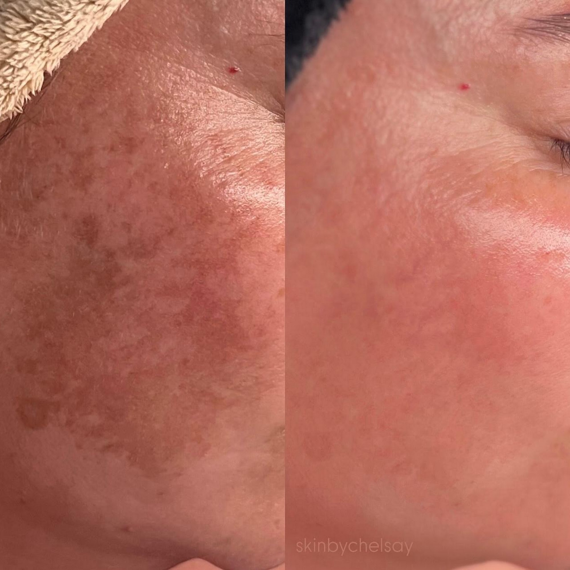 Jambell Advanced Aesthetics 997 S Creasy Ln, Lafayette Indiana 47905