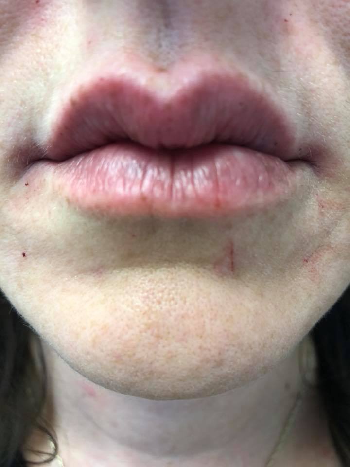 Randall Dermatology