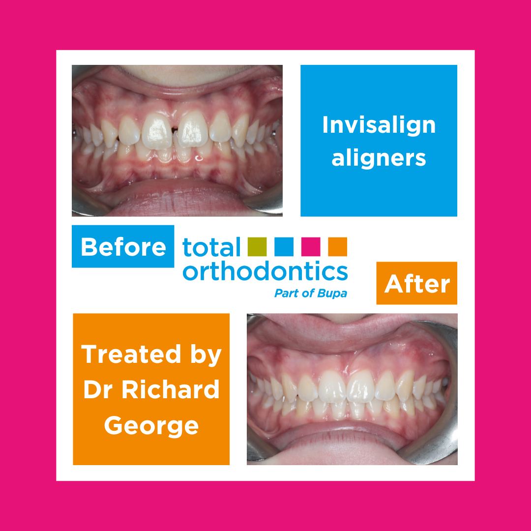 Total Orthodontics Tunbridge Wells