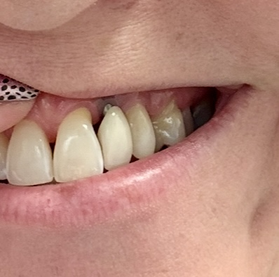 Mettens and Stewart Dental