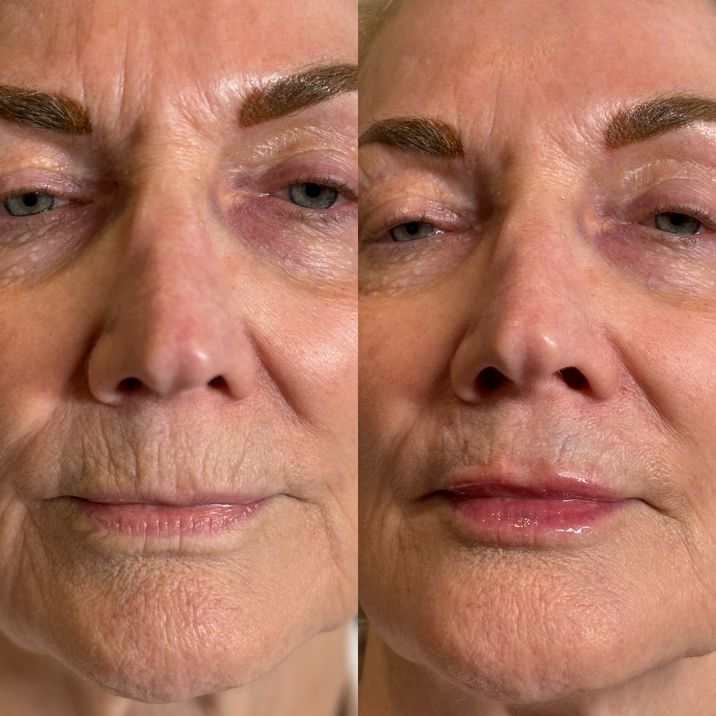 NoCo Spa & Aesthetics