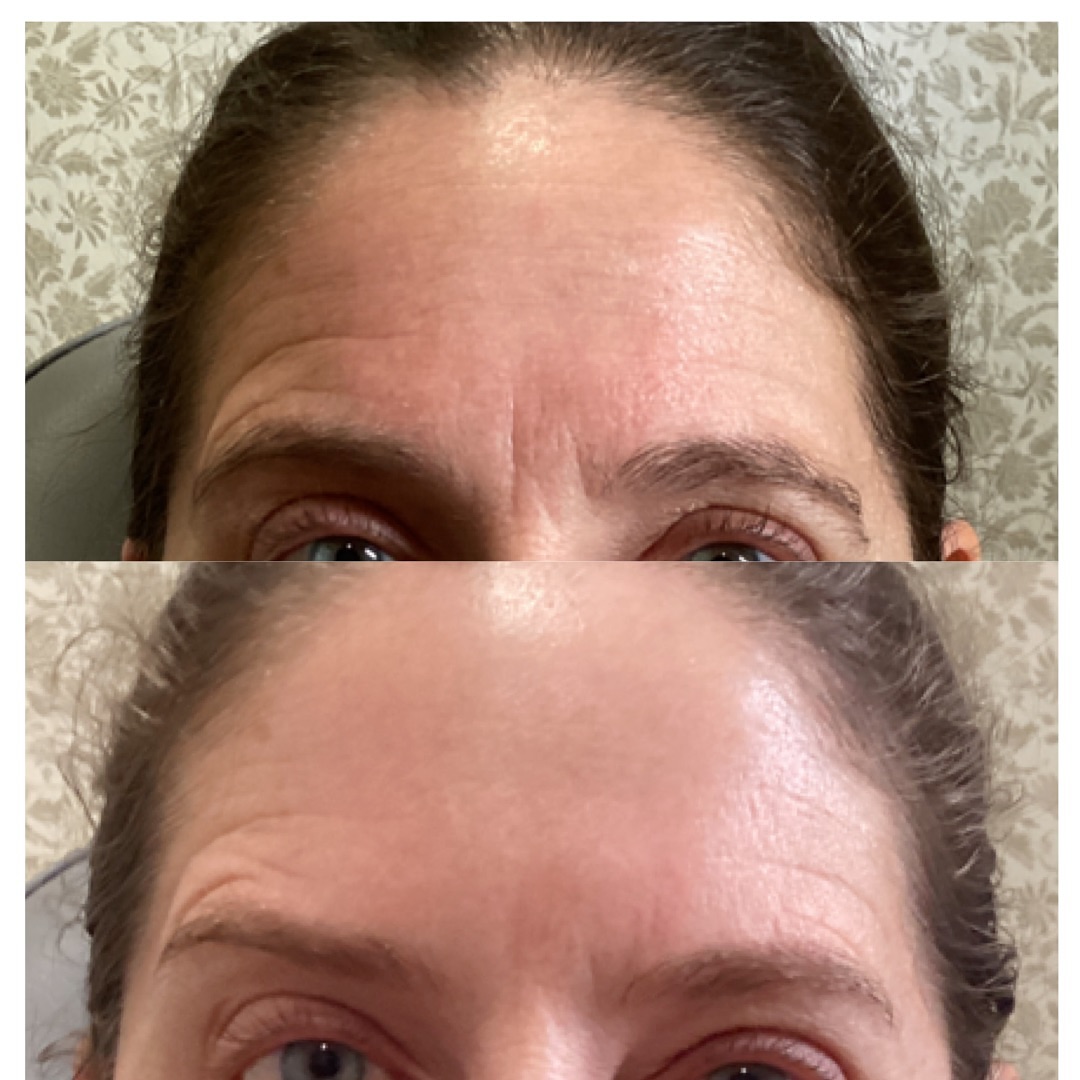 NoCo Spa & Aesthetics