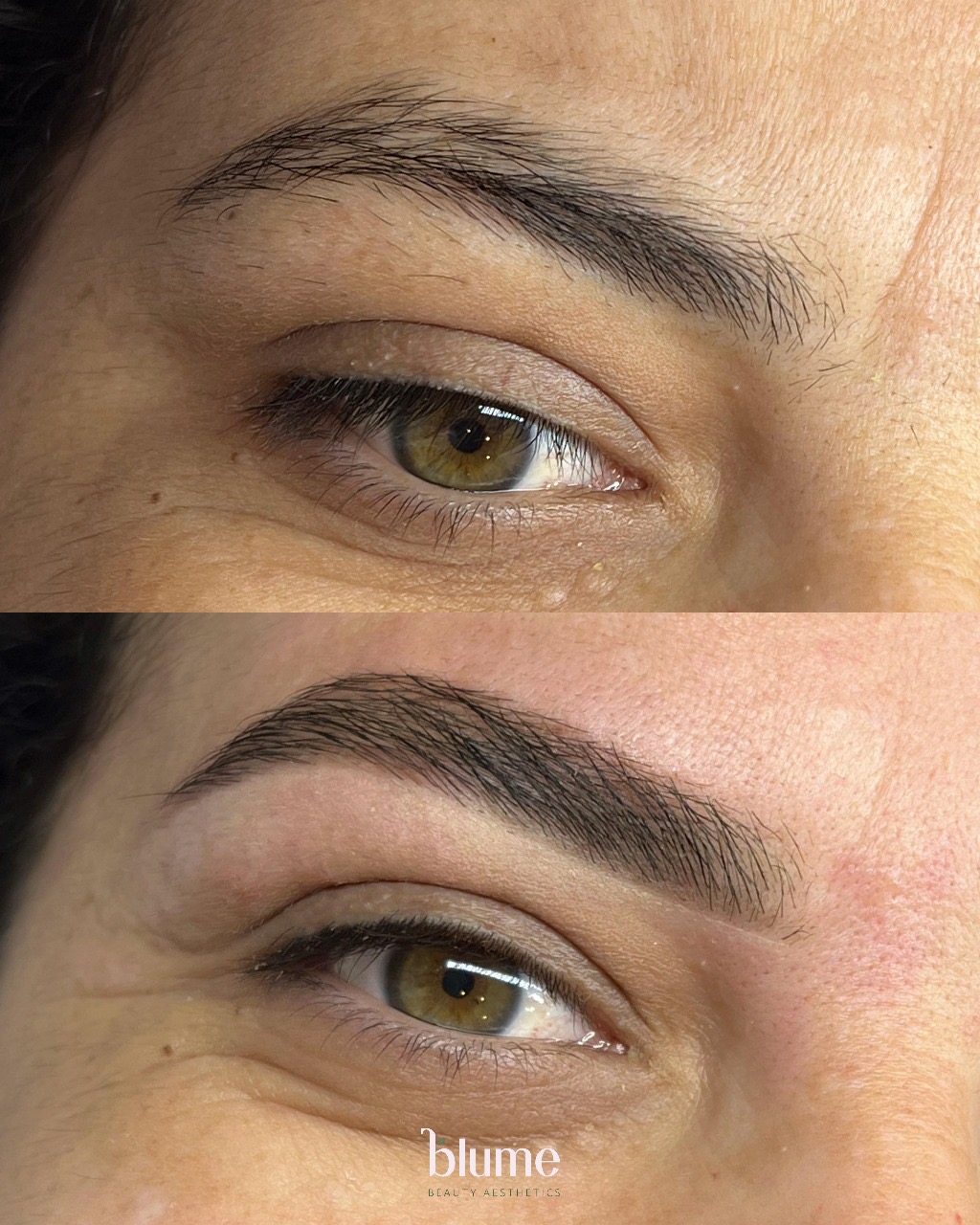 Blume Beauty Aesthetics 630 Boston Rd, Billerica Massachusetts 01821