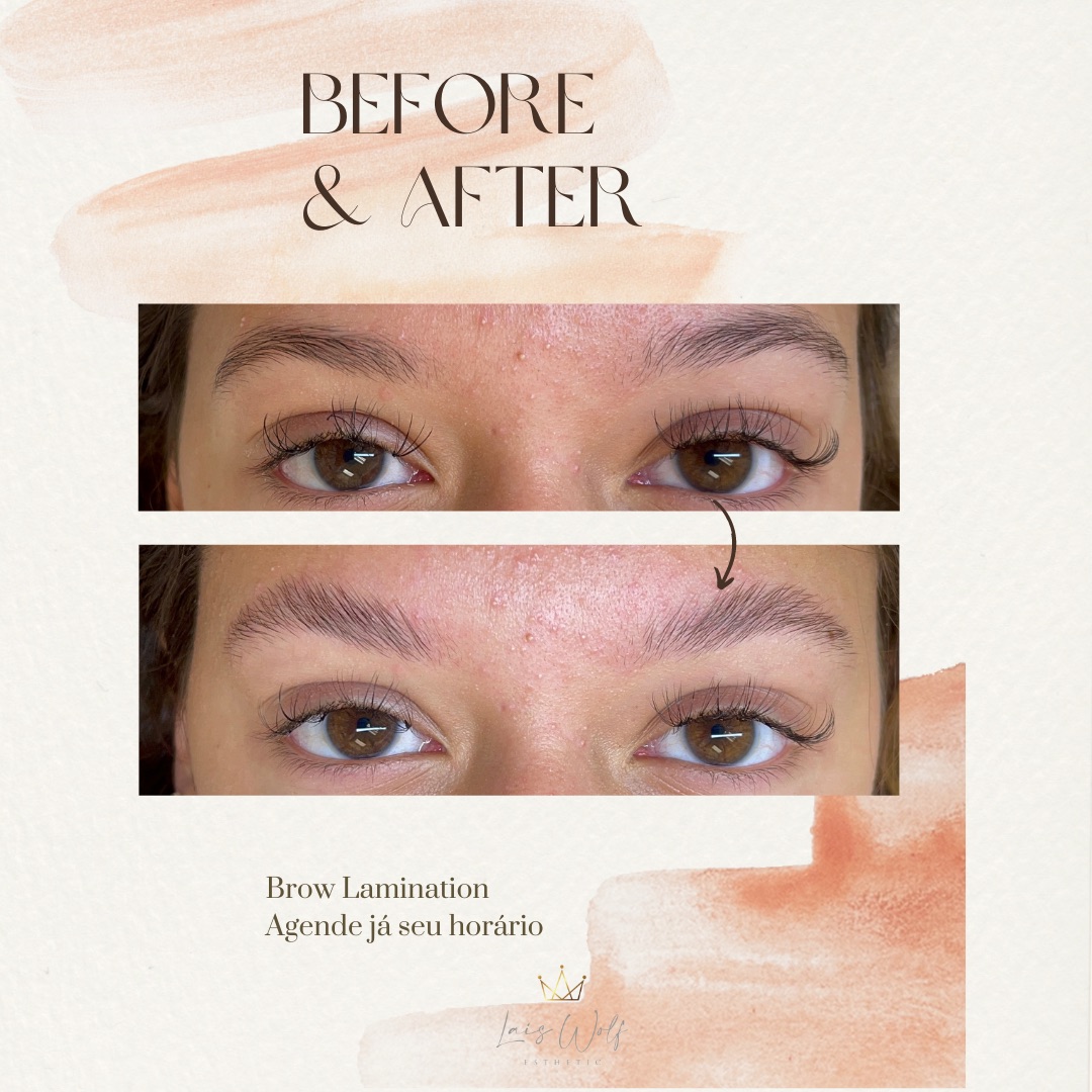 Lais Wolf Esthetics 182 Highland Ave, Malden Massachusetts 02148