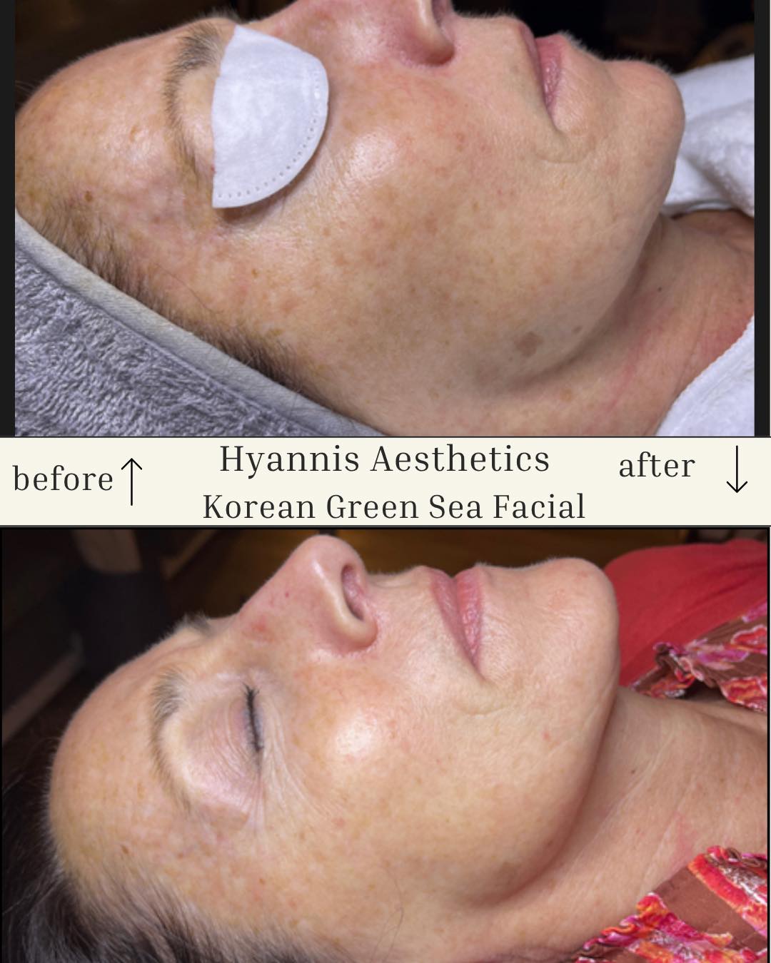 Marylou's Electrology & Laser Hair Removal