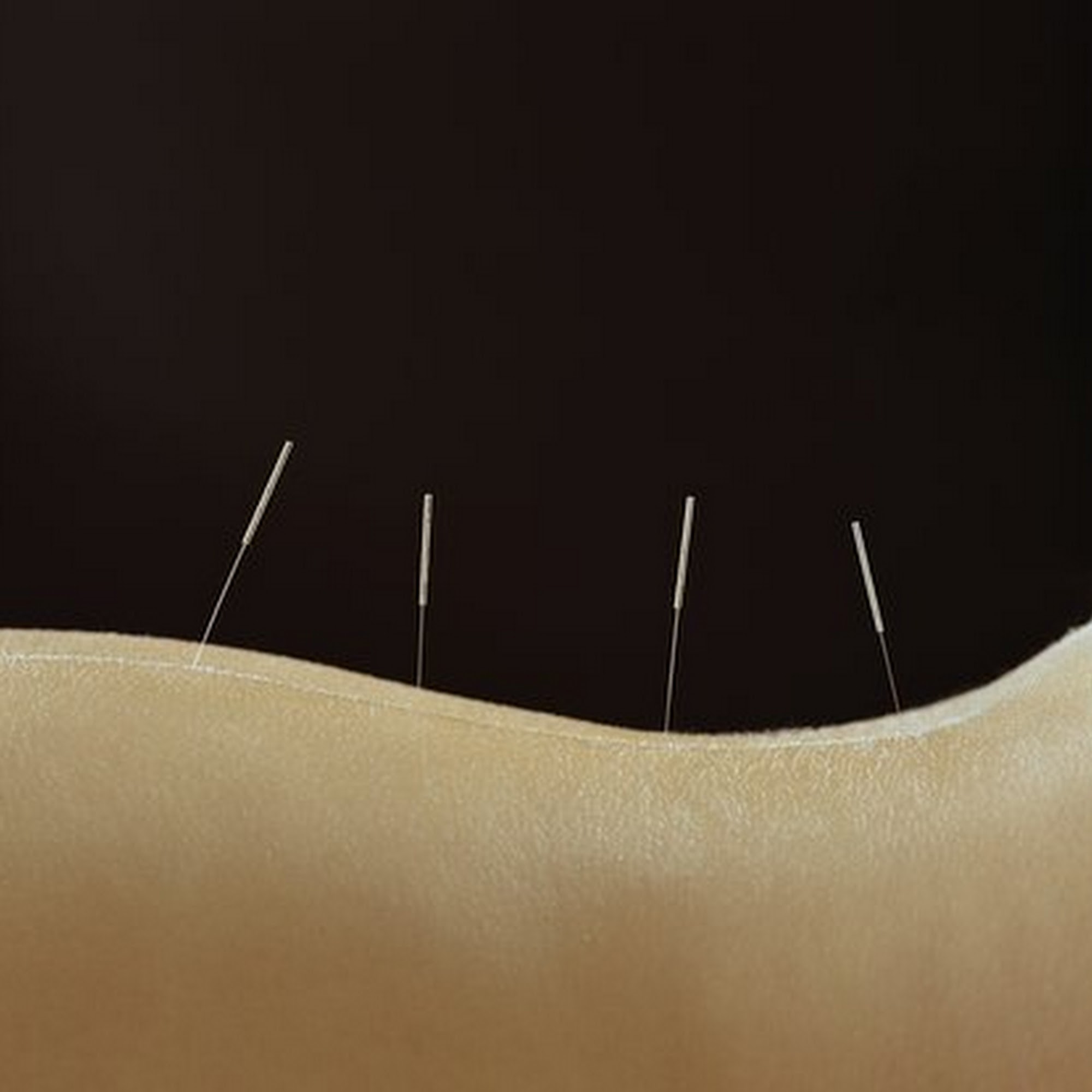 Vineyard Sound Acupuncture Center
