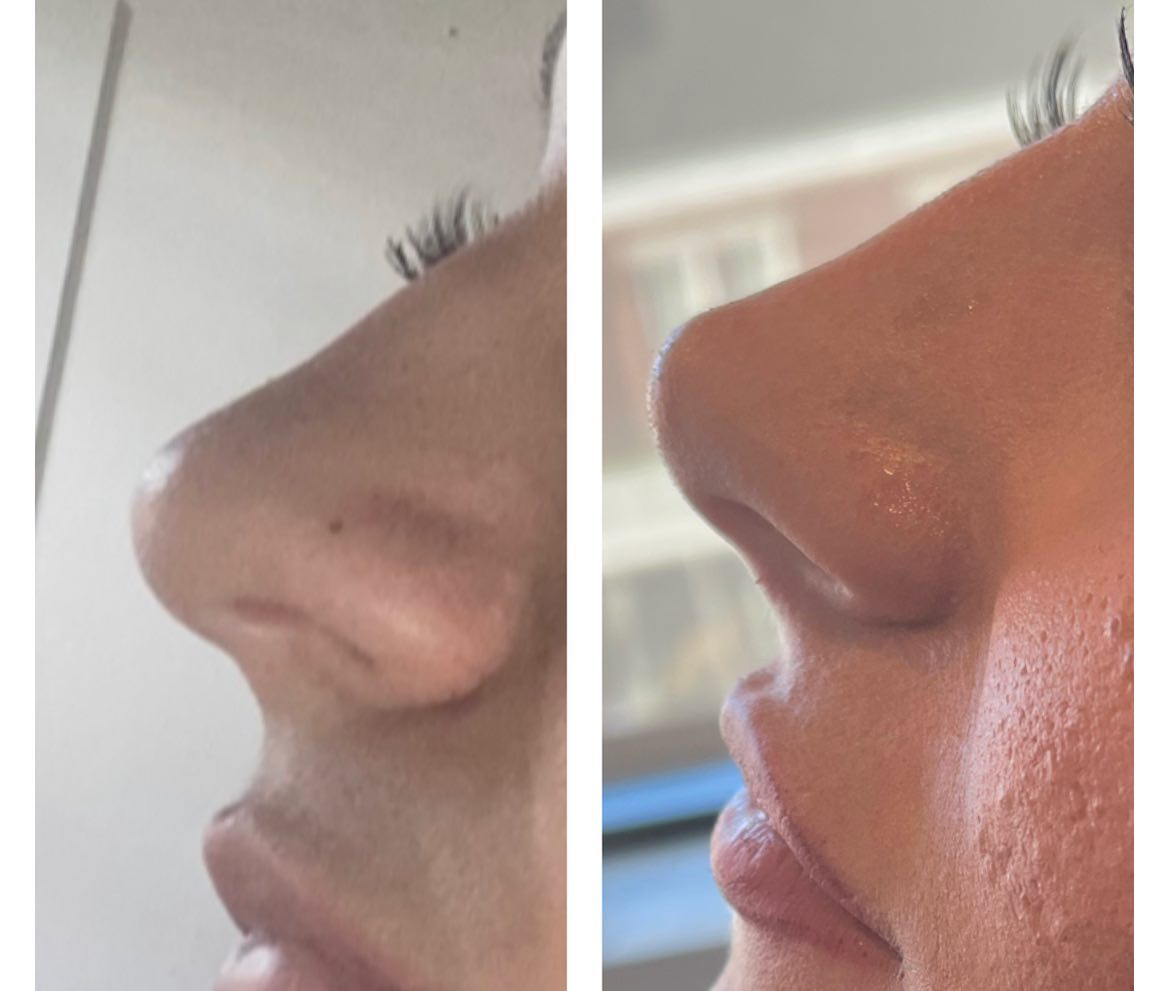 IQ Esthetics