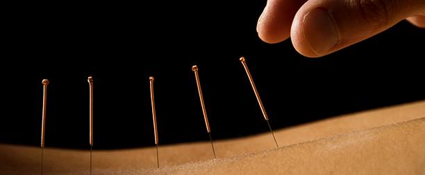 Potomac Acupuncture- Bella Mosenkis