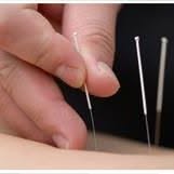 Potomac Acupuncture- Bella Mosenkis