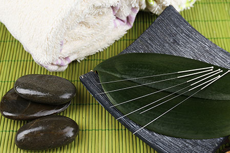 Potomac Acupuncture- Bella Mosenkis