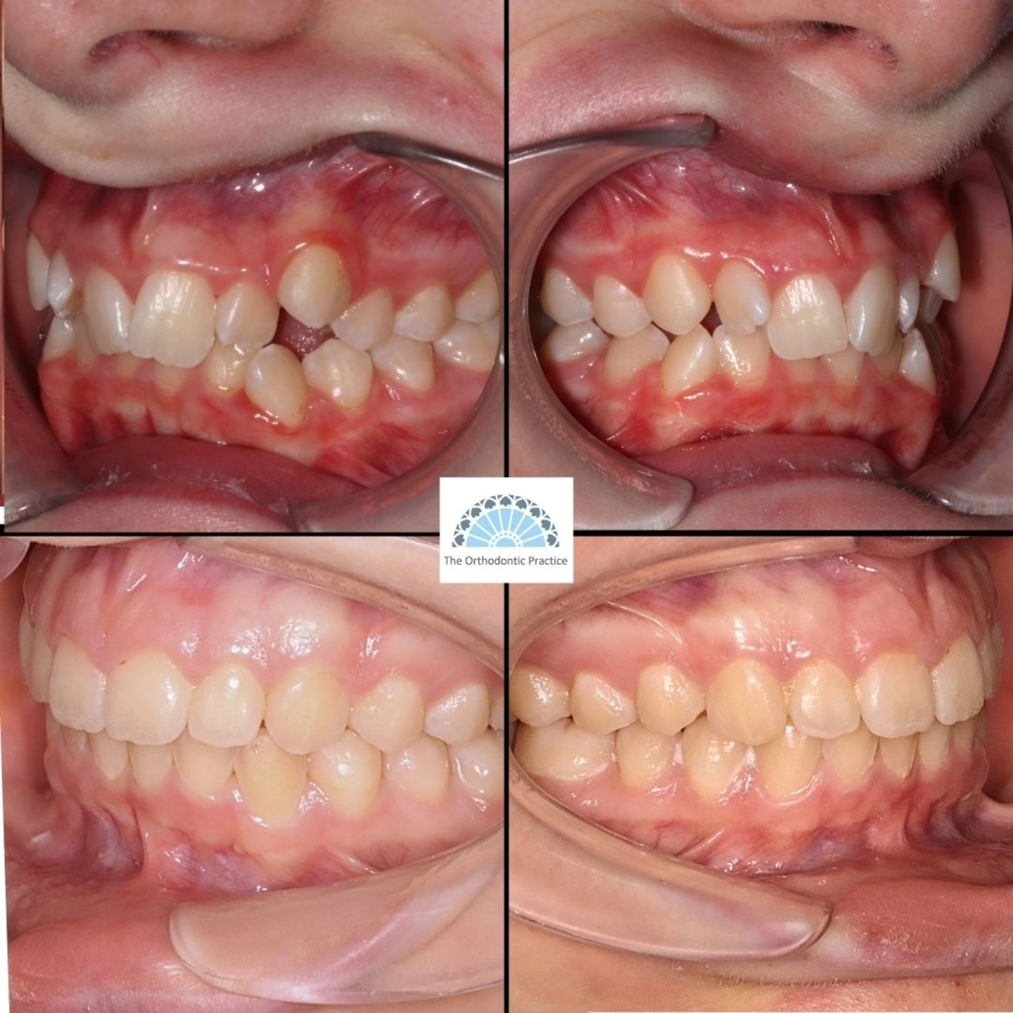 The Orthodontic Practice