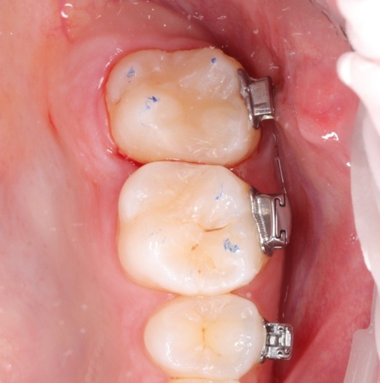 Haymans Green Dental Practice