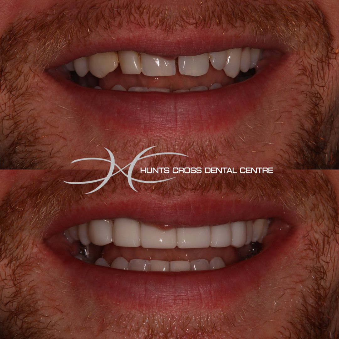 Hunts Cross Dental Centre