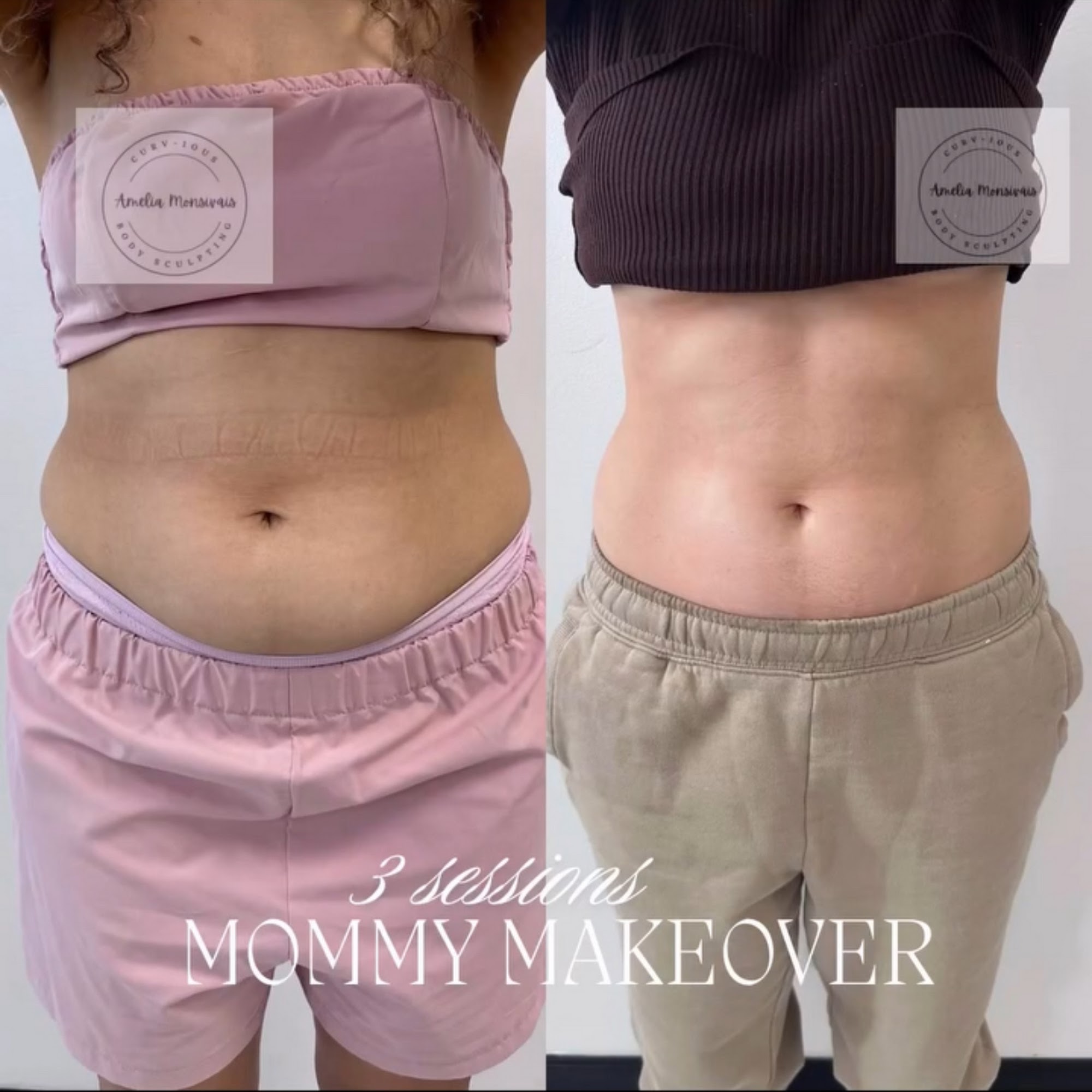 Curv-Ious Body Sculpting 1325 E 66th St, Richfield Minnesota 55423