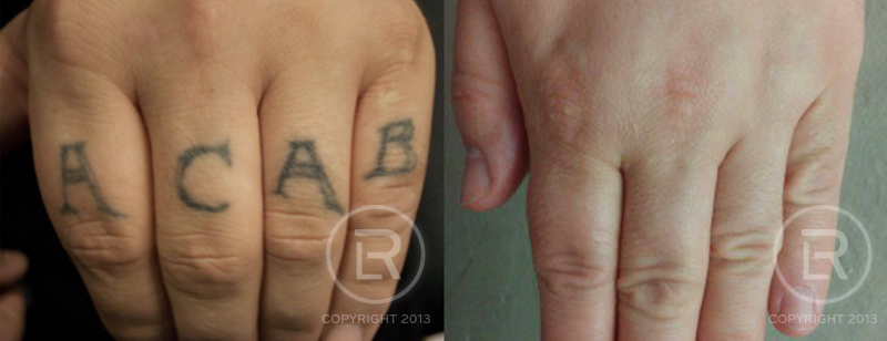 Renewal Laser Clinic 2002 2nd St SW #7, Rochester Minnesota 55902