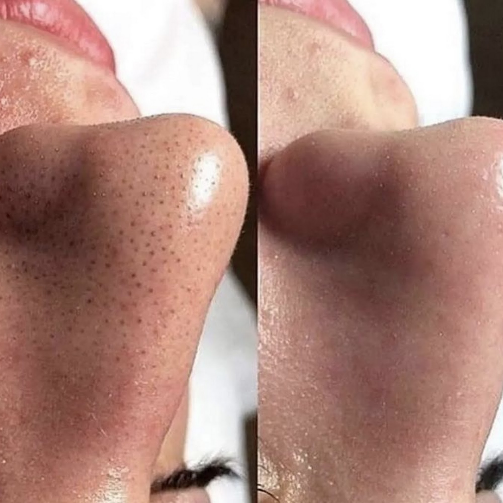 Superior Skin Aesthetics