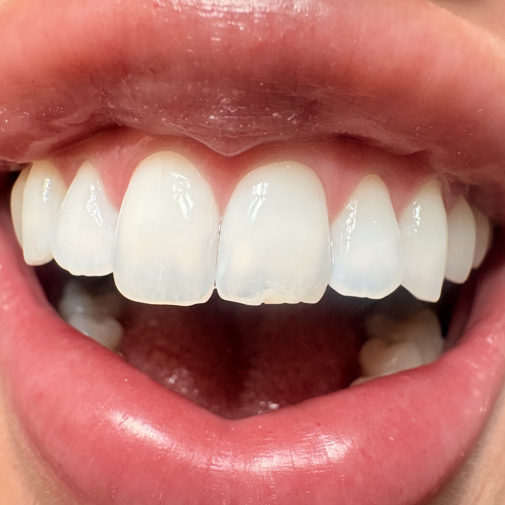 Celebrate Dental & Braces - Independence