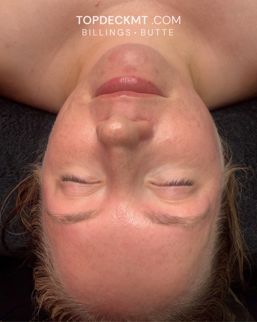 Top Deck Medical Aesthetics and Wellness 160 W Granite St Suite A, Butte Montana 59701