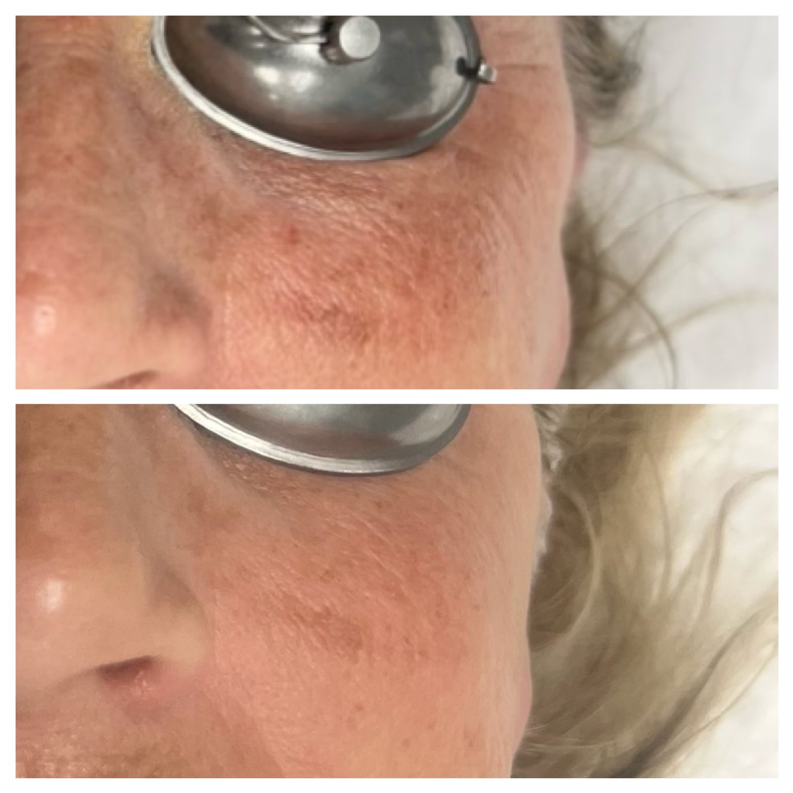 Mint Skin Studio 2100 W Cornwallis Dr unit V, Greensboro North Carolina 27408