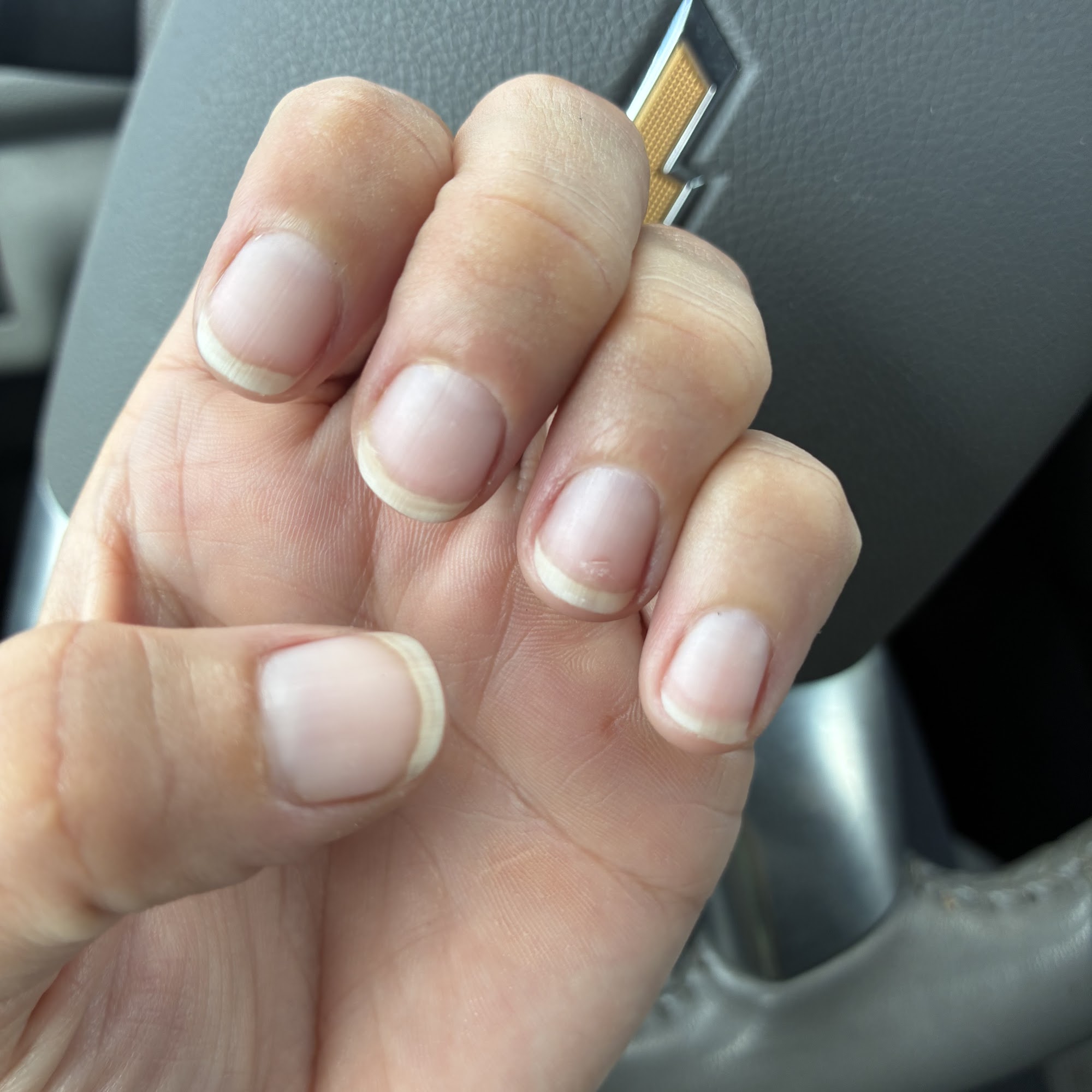 K Nail