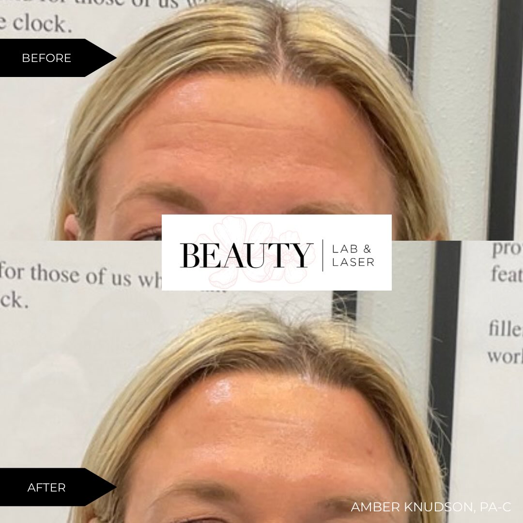 Beauty Lab & Laser 101 E Front Ave, Bismarck North Dakota 58504