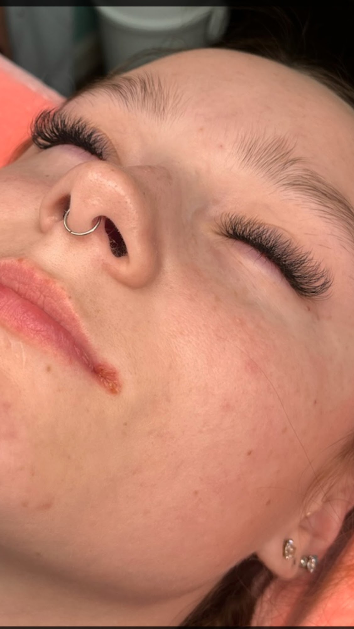 BodyGlo Omaha Laser Hair Removal & Spa