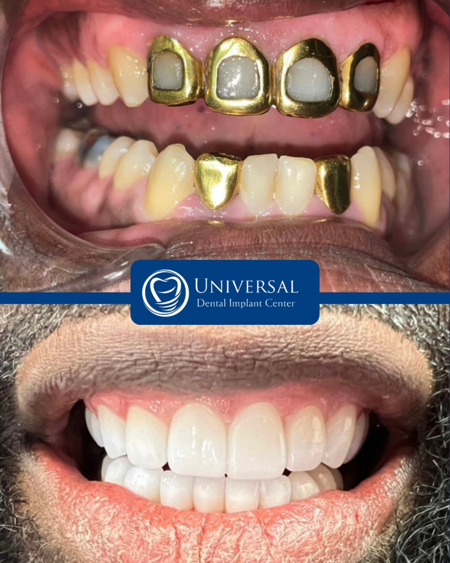 Universal Dental Implant Center