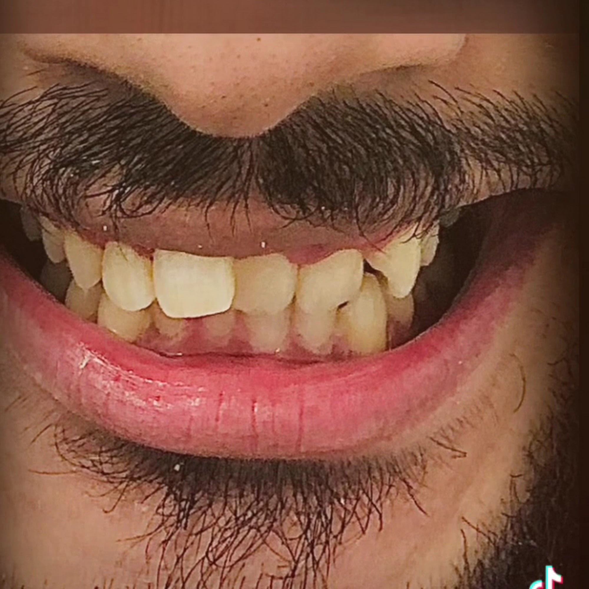 Smile With Style Dental Care - Dr. Mina Youssef DDS 873 Bergen Ave 1st FL, Jersey City New Jersey 07306