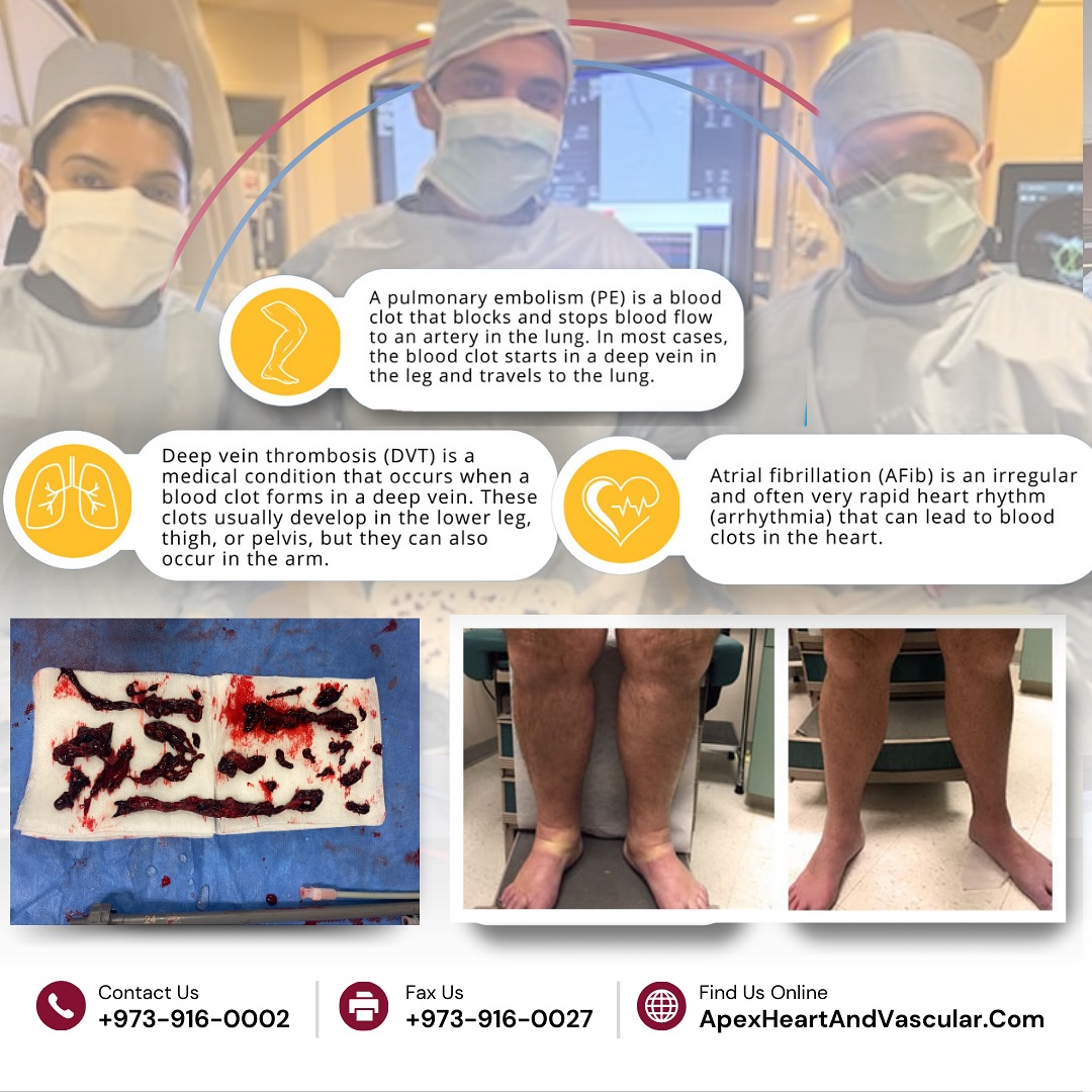 Cardiovascular Diagnostics