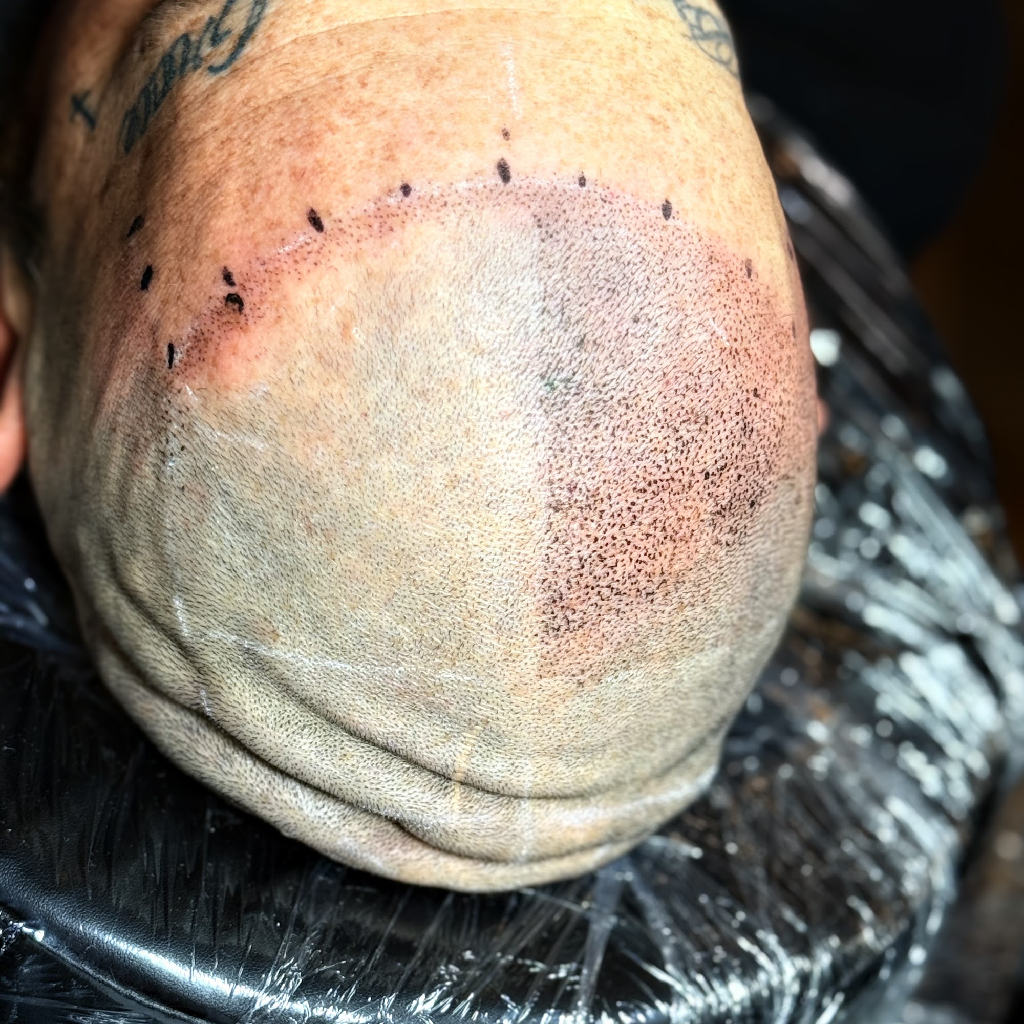 New Mexico SMP Scalp Micropigmentation Clinic 6705 4th St NW, Los Ranchos De Albuquerque New Mexico 87107