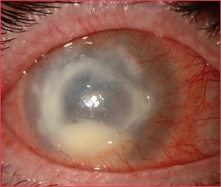 Long Stratton Eyecare