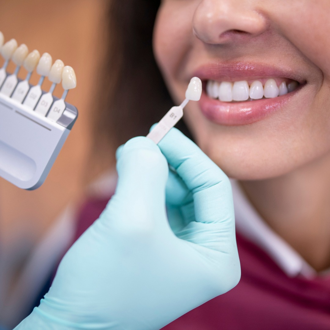 Bupa Dental Care Newark