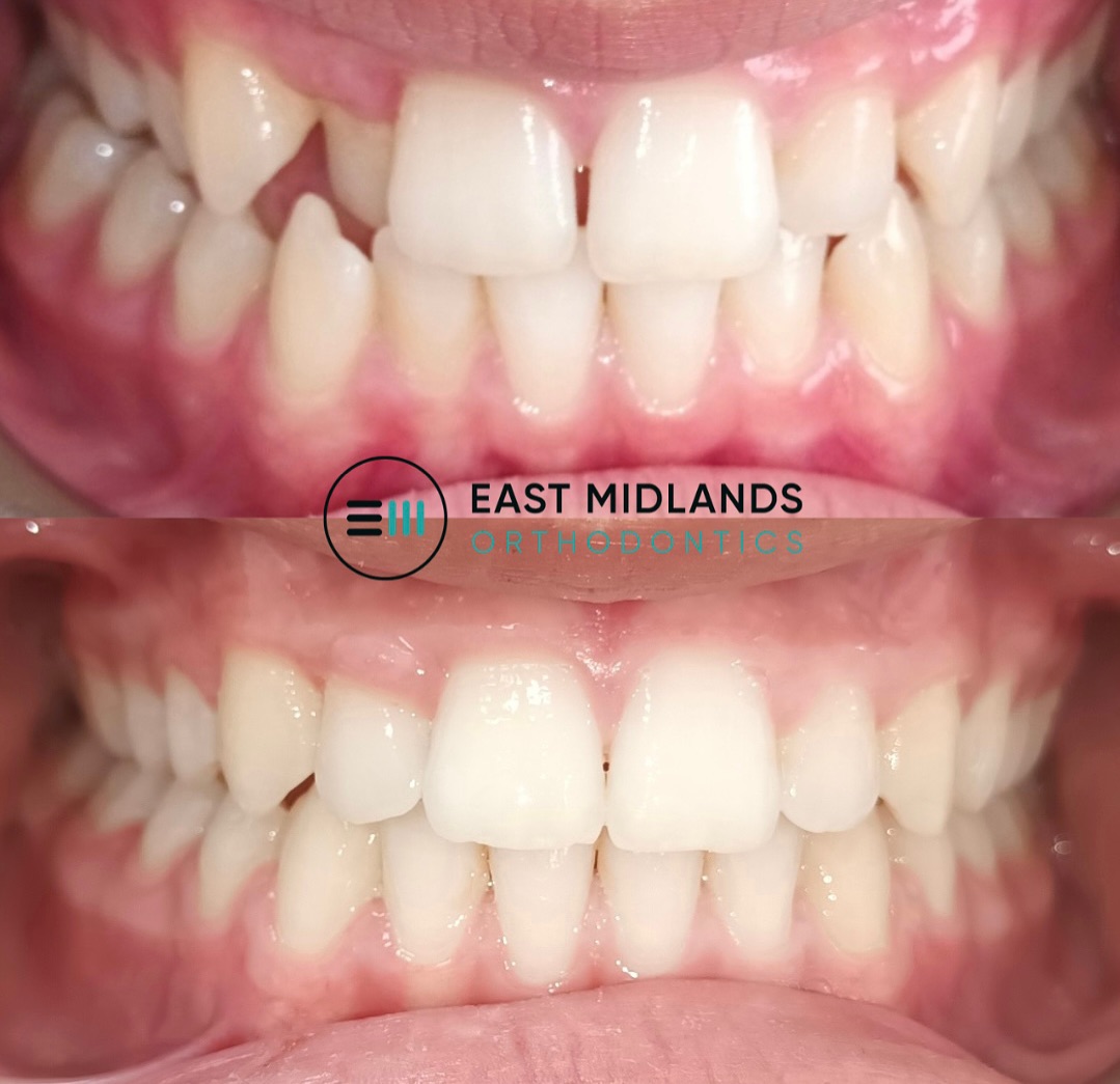 East Midlands Orthodontics